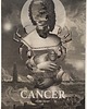 grafiki i ilustracje Cancer 1
