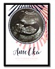 kubki Plakat ze zdjęciem usg, w ciąży z imieniem 3